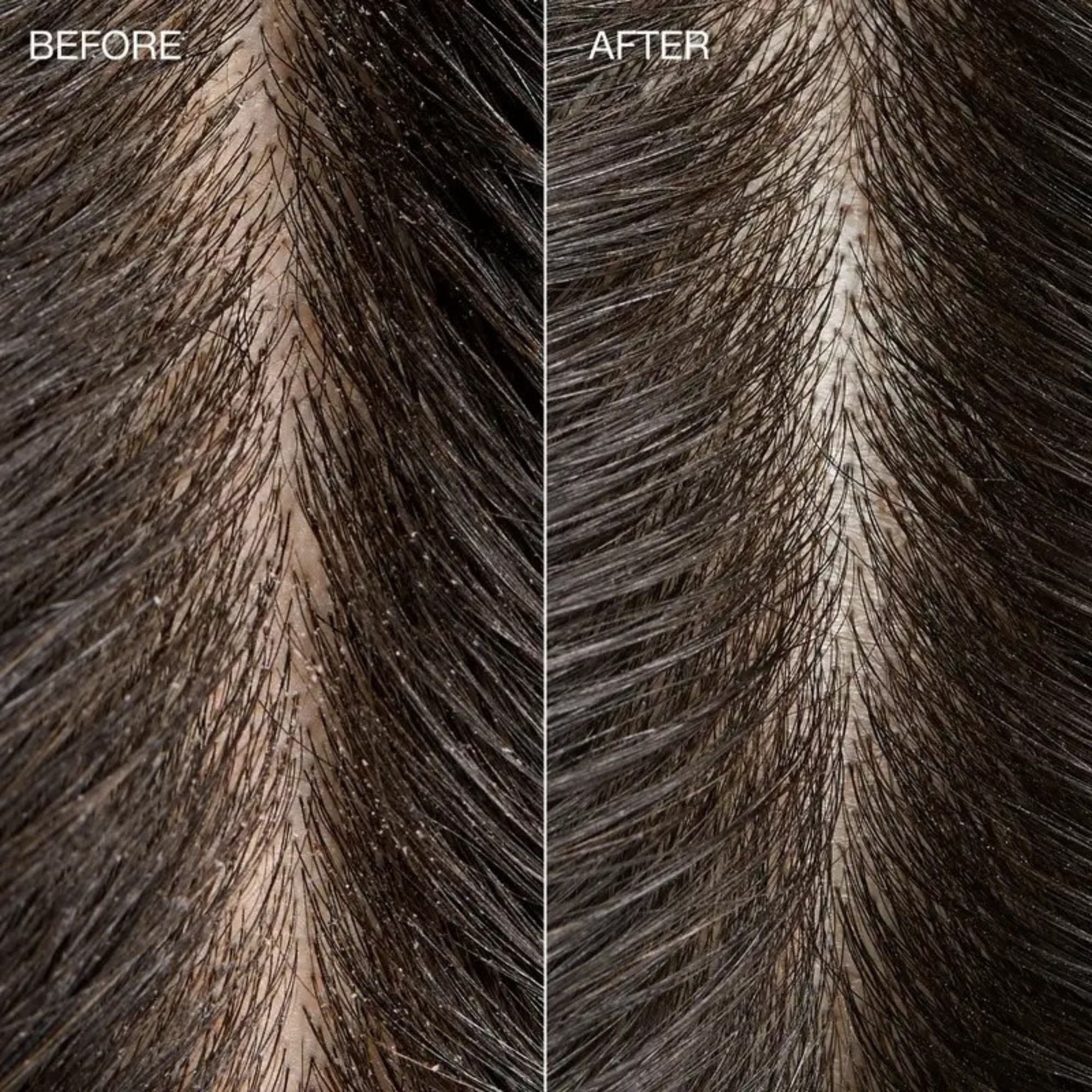 TEA TREE SPECIAL DETOX KOMBUCHA RINSE - size 75 ml